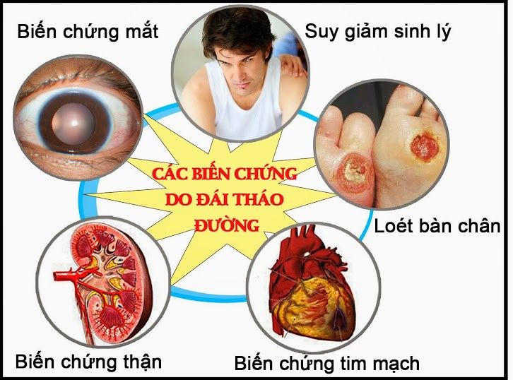 biến chứng do bệnh ĐTĐ.jpg